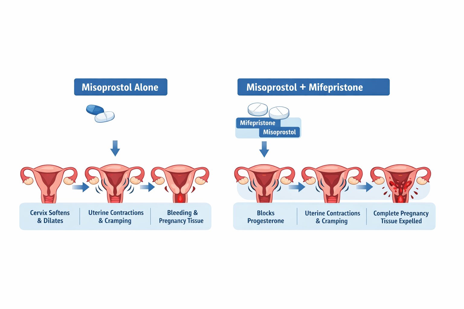 How Does Misoprostol Work for Medication Abortion?