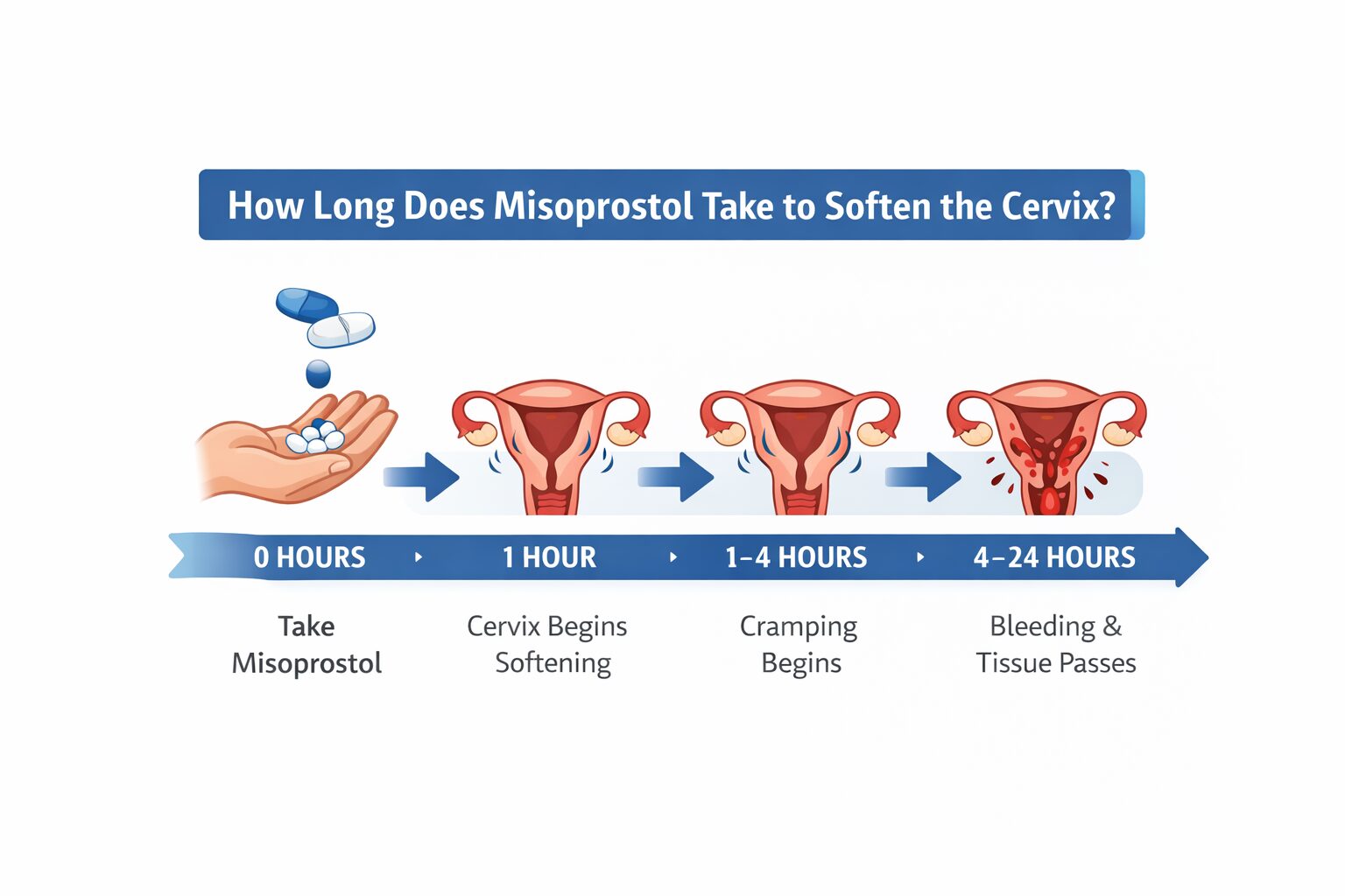 How Long Does It Take Misoprostol to Soften the Cervix?