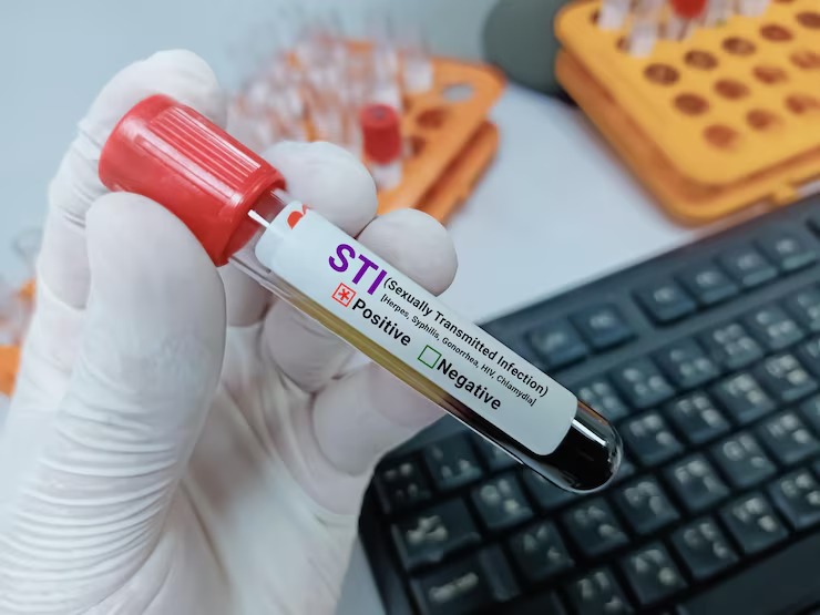 STI & STD Testing Services in Oak Park, IL