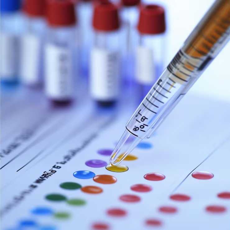 Sexually Transmitted Infections (also known as STDs) Testing: What is it?
