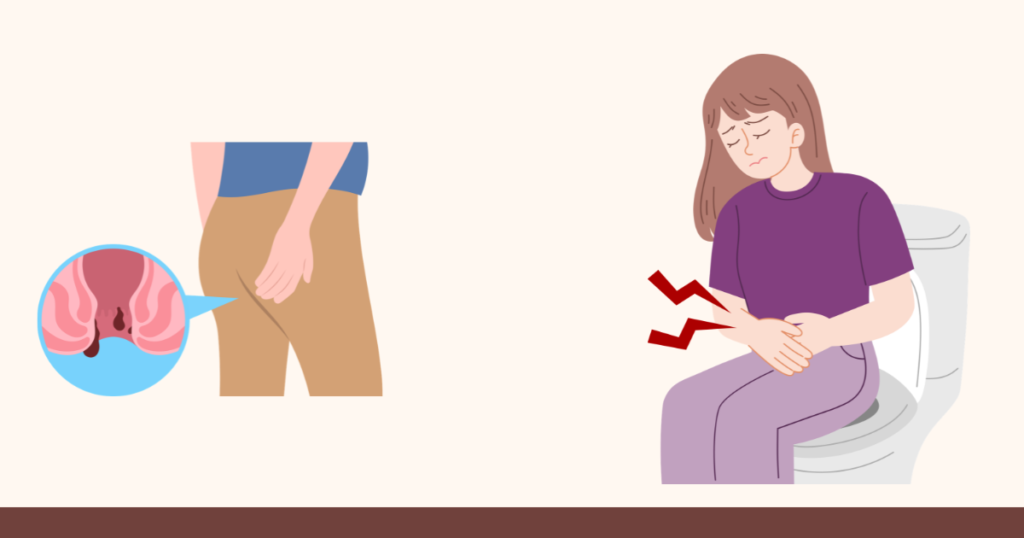 Constipation and Anal Pain After Abortion Pills