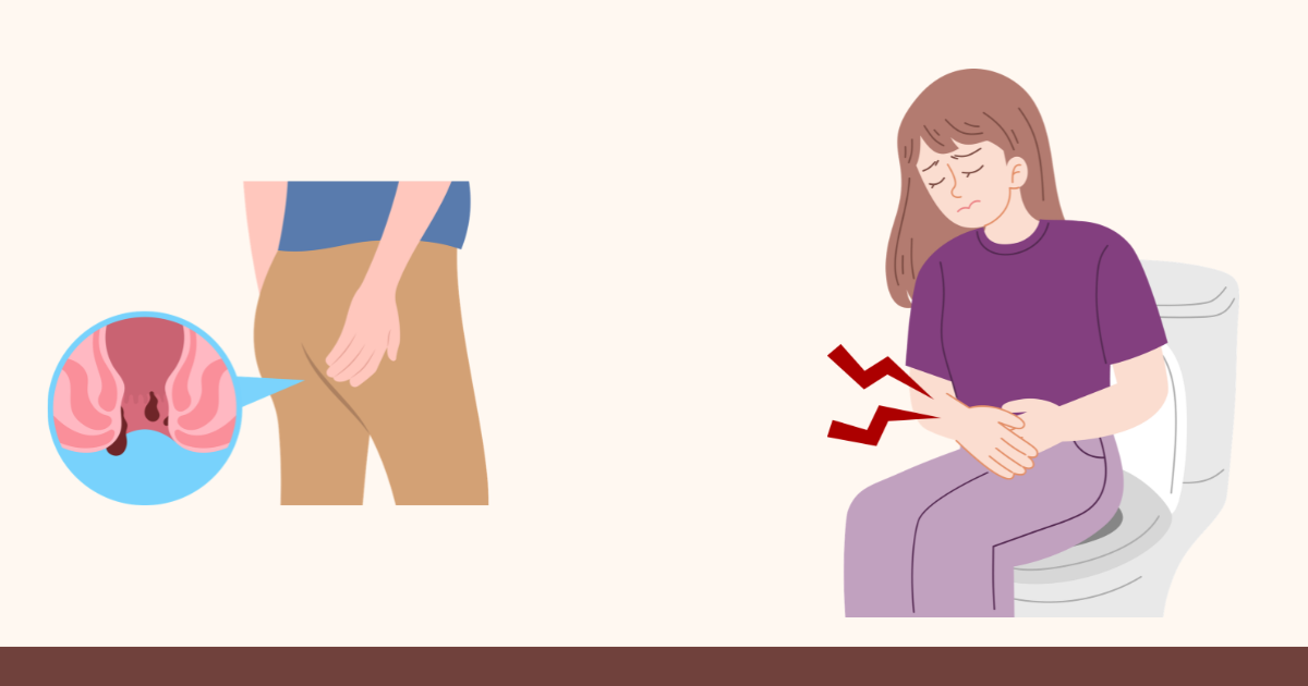 Constipation & Anal Pain After Abortion Pills | Serenity