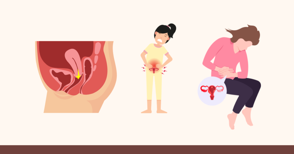 Pelvic and Rectal Pain After Abortion: Causes and Warning Signs