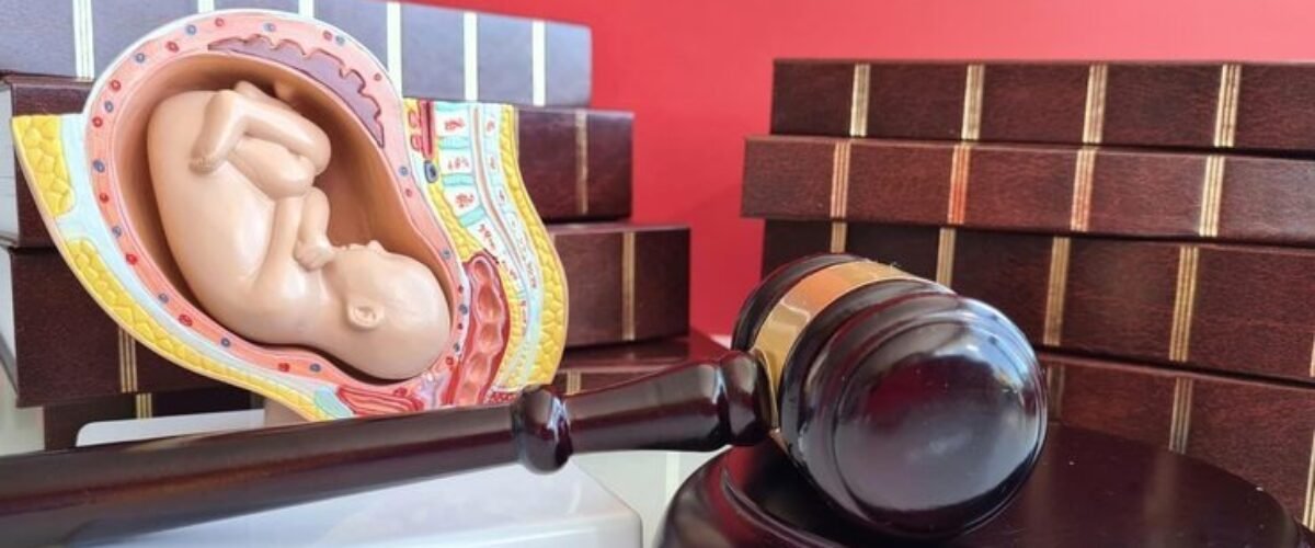 Are 20 week abortions legal?